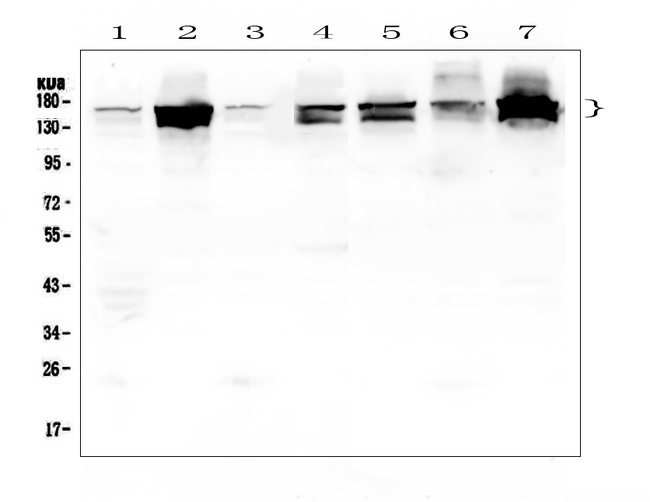 INPPL1 / SHIP2 Antibody - Western blot analysis of INPPL1 using anti-INPPL1 antibody. Electrophoresis was performed on a 5-20% SDS-PAGE gel at 70V (Stacking gel) / 90V (Resolving gel) for 2-3 hours. The sample well of each lane was loaded with 50ug of sample under reducing conditions. Lane 1: human placenta tissue lysates,Lane 2: human Hela whole cell lysate,Lane 3: human U20S whole cell lysate,Lane 4: human PC-3 whole cell lysate,Lane 5: human Caco-2 whole cell lysate,Lane 6: human A549 whole cell lysate,Lane 7: human K562 whole cell lysate. After Electrophoresis, proteins were transferred to a Nitrocellulose membrane at 150mA for 50-90 minutes. Blocked the membrane with 5% Non-fat Milk/ TBS for 1.5 hour at RT. The membrane was incubated with rabbit anti-INPPL1 antigen affinity purified polyclonal antibody at 0.5 µg/mL overnight at 4°C, then washed with TBS-0.1% Tween 3 times with 5 minutes each and probed with a goat anti-rabbit IgG-HRP secondary antibody at a dilution of 1:10000 for 1.5 hour at RT. The signal is developed using an Enhanced Chemiluminescent detection (ECL) kit with Tanon 5200 system. A specific band was detected for INPPL1 at approximately 140-160KD. The expected band size for INPPL1 is at 138KD.