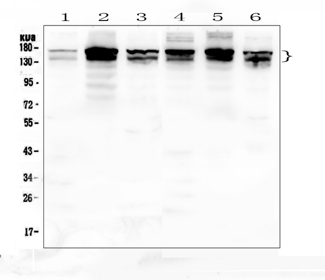INPPL1 / SHIP2 Antibody - Western blot analysis of INPPL1 using anti-INPPL1 antibody. Electrophoresis was performed on a 5-20% SDS-PAGE gel at 70V (Stacking gel) / 90V (Resolving gel) for 2-3 hours. The sample well of each lane was loaded with 50ug of sample under reducing conditions. Lane 1: rat lung tissue lysates,Lane 2: rat ovary tissue lysates,Lane 3: rat brain tissue lysates,Lane 4: mouse lung tissue lysates,Lane 5: mouse ovary tissue lysates,Lane 6: mouse brain tissue lysates. After Electrophoresis, proteins were transferred to a Nitrocellulose membrane at 150mA for 50-90 minutes. Blocked the membrane with 5% Non-fat Milk/ TBS for 1.5 hour at RT. The membrane was incubated with rabbit anti-INPPL1 antigen affinity purified polyclonal antibody at 0.5 µg/mL overnight at 4°C, then washed with TBS-0.1% Tween 3 times with 5 minutes each and probed with a goat anti-rabbit IgG-HRP secondary antibody at a dilution of 1:10000 for 1.5 hour at RT. The signal is developed using an Enhanced Chemiluminescent detection (ECL) kit with Tanon 5200 system. A specific band was detected for INPPL1 at approximately 140-160KD. The expected band size for INPPL1 is at 138KD.