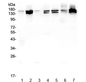 INPPL1 / SHIP2 Antibody - Western blot testing of human 1) placenta, 2) HeLa, 3) U-2 OS, 4) PC-3, 5) Caco-2, 6) A549 and 7) K562 lysate with SHIP2 antibody at 0.5ug/ml. Predicted molecular weight ~139 kDa (isoform 1), ~113 kDa (isoform 2).