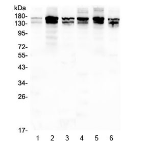 INPPL1 / SHIP2 Antibody - Western blot testing of rat 1) lung, 2) ovary, 3) brain and mouse 4) lung, 5) ovary and 6) brain lysate with SHIP2 antibody at 0.5ug/ml. Predicted molecular weight ~139 kDa (isoform 1), ~113 kDa (isoform 2).
