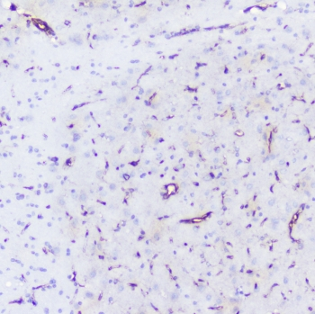 INPPL1 / SHIP2 Antibody - IHC staining of FFPE rat brain with SHIP2 antibody at 1ug/ml. HIER: boil tissue sections in pH6, 10mM citrate buffer, for 10-20 min followed by cooling at RT for 20 min.