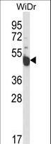 INSC Antibody - Western blot of INSC Antibody in WiDr cell line lysates (35 ug/lane). INSC (arrow) was detected using the purified antibody.