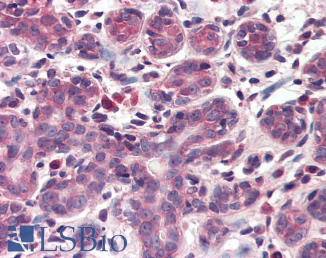 INSIG1 Antibody - Anti-INSIG1 antibody IHC of human breast. Immunohistochemistry of formalin-fixed, paraffin-embedded tissue after heat-induced antigen retrieval. Antibody concentration 5 ug/ml.  This image was taken for the unconjugated form of this product. Other forms have not been tested.