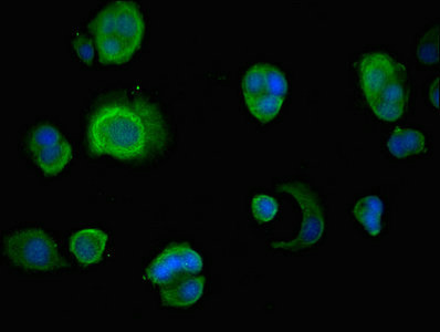 INSIG1 Antibody - Immunofluorescent analysis of MCF-7 cells at a dilution of 1:100 and Alexa Fluor 488-congugated AffiniPure Goat Anti-Rabbit IgG(H+L)