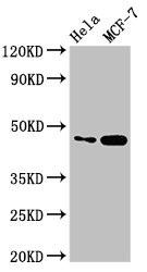 INSIG1 Antibody - Positive Western Blot detected in Hela whole cell lysate, MCF-7 whole cell lysate. All lanes: INSIG1 antibody at 2.8 µg/ml Secondary Goat polyclonal to rabbit IgG at 1/50000 dilution. Predicted band size: 30, 18 KDa. Observed band size: 46 KDa