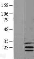 INSIG1 Protein - Western validation with an anti-DDK antibody * L: Control HEK293 lysate R: Over-expression lysate