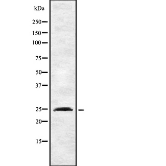 INSIG2 Antibody - Western blot analysis INSIG2 using HeLa whole cells lysates