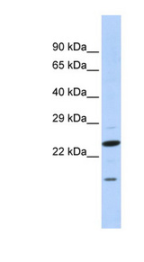 INSIG2 Antibody - INSIG2 antibody Western blot of Fetal Brain lysate. This image was taken for the unconjugated form of this product. Other forms have not been tested.