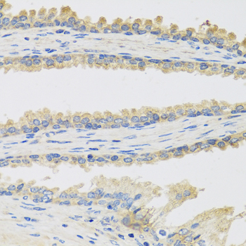 INSL3 Antibody - Immunohistochemistry of paraffin-embedded human prostate.