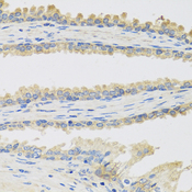 INSL3 Antibody - Immunohistochemistry of paraffin-embedded human prostate.
