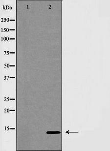 INSL3 Antibody - Western blot analysis of INSL3 expression in MCF-7 cells. The lane on the left is treated with the antigen-specific peptide.