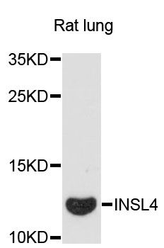 INSL4 Antibody - Western blot analysis of extracts of rat lung, using INSL4 antibody at 1:3000 dilution. The secondary antibody used was an HRP Goat Anti-Rabbit IgG (H+L) at 1:10000 dilution. Lysates were loaded 25ug per lane and 3% nonfat dry milk in TBST was used for blocking. An ECL Kit was used for detection and the exposure time was 90s.