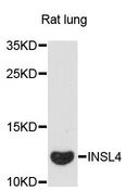 INSL4 Antibody - Western blot analysis of extracts of rat lung, using INSL4 antibody at 1:3000 dilution. The secondary antibody used was an HRP Goat Anti-Rabbit IgG (H+L) at 1:10000 dilution. Lysates were loaded 25ug per lane and 3% nonfat dry milk in TBST was used for blocking. An ECL Kit was used for detection and the exposure time was 90s.