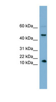 INSL5 Antibody - INSL5 antibody Western blot of HeLa lysate. This image was taken for the unconjugated form of this product. Other forms have not been tested.