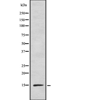INSL5 Antibody - Western blot analysis INSL5 using HeLa whole cells lysates
