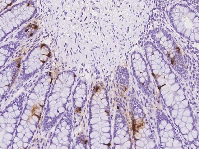 INSL5 Antibody - Immunochemical staining of human INSL5 in human rectum with rabbit polyclonal antibody at 1:2000 dilution, formalin-fixed paraffin embedded sections.