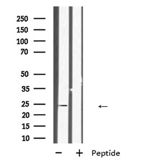 INSL6 Antibody - Western blot analysis of INSL6 expression in human fetal kidney lysate. The lane on the left is treated with the antigen-specific peptide.