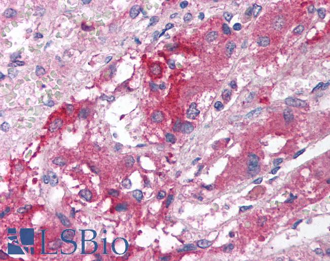 INSM1 Antibody - Anti-INSM1 antibody IHC staining of human adrenal. Immunohistochemistry of formalin-fixed, paraffin-embedded tissue after heat-induced antigen retrieval. Antibody concentration 5 ug/ml.  This image was taken for the unconjugated form of this product. Other forms have not been tested.