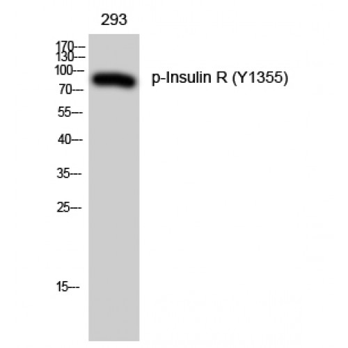 INSR / Insulin Receptor Antibody - Western blot of Phospho-Insulin R (Y1355) antibody
