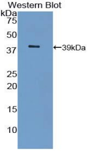 INSR / Insulin Receptor Antibody - Western blot of recombinant INSR / Insulin Receptor.  This image was taken for the unconjugated form of this product. Other forms have not been tested.