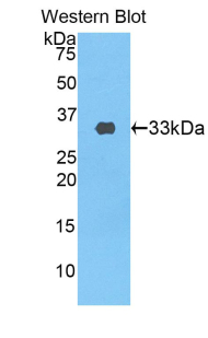 INSR / Insulin Receptor Antibody - Western blot of recombinant INSR / Insulin Receptor.  This image was taken for the unconjugated form of this product. Other forms have not been tested.