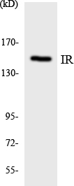 INSR / Insulin Receptor Antibody - Western blot analysis of the lysates from K562 cells using IR antibody.