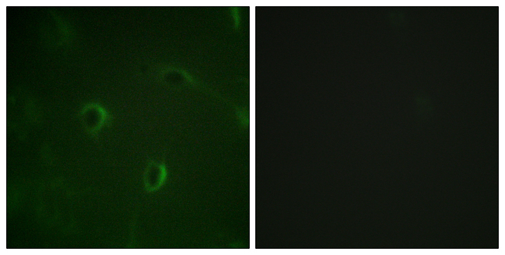 INSR / Insulin Receptor Antibody - Immunofluorescence analysis of HUVEC cells, using IR Antibody. The picture on the right is blocked with the synthesized peptide.
