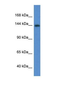 INSR / Insulin Receptor Antibody - INSR / Insulin Receptor antibody Western blot of Mouse Pancreas lysate. Antibody concentration 1 ug/ml. This image was taken for the unconjugated form of this product. Other forms have not been tested.