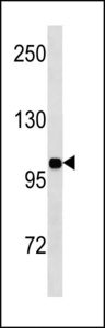 INSR / Insulin Receptor Antibody - INSR Antibody western blot of MDA-MB453 cell line lysates (35 ug/lane). The INSR antibody detected the INSR protein (arrow).