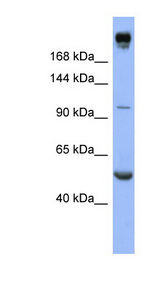 INSR / Insulin Receptor Antibody - INSR / Insulin Receptor antibody Western blot of HT1080 cell lysate. This image was taken for the unconjugated form of this product. Other forms have not been tested.