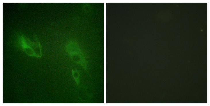 INSR / Insulin Receptor Antibody - Immunofluorescence analysis of NIH/3T3 cells, using IR Antibody. The picture on the right is blocked with the synthesized peptide.