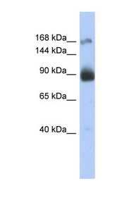 INSR / Insulin Receptor Antibody - INSR / Insulin Receptor antibody Western blot of THP-1 cell lysate. This image was taken for the unconjugated form of this product. Other forms have not been tested.