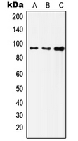 INSR / Insulin Receptor Antibody - Western blot analysis of Insulin Receptor expression in HeLa (A); SKOV3 (B); HepG2 (C) whole cell lysates.