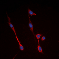 INSR / Insulin Receptor Antibody - Immunofluorescent analysis of Insulin Receptor staining in A549 cells. Formalin-fixed cells were permeabilized with 0.1% Triton X-100 in TBS for 5-10 minutes and blocked with 3% BSA-PBS for 30 minutes at room temperature. Cells were probed with the primary antibody in 3% BSA-PBS and incubated overnight at 4 deg C in a humidified chamber. Cells were washed with PBST and incubated with a DyLight 594-conjugated secondary antibody (red) in PBS at room temperature in the dark. DAPI was used to stain the cell nuclei (blue).