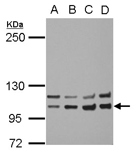 INSR / Insulin Receptor Antibody - Sample (30 ug of whole cell lysate) A: A549 B: H1299 C: HCT116 D: MCF-7 5% SDS PAGE Insulin Receptor antibody diluted at 1:1000