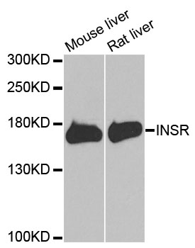 INSR / Insulin Receptor Antibody - Western blot analysis of extracts of various cell lines.