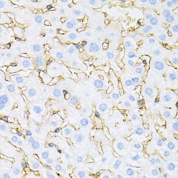 INSR / Insulin Receptor Antibody - Immunohistochemistry of paraffin-embedded mouse liver tissue.