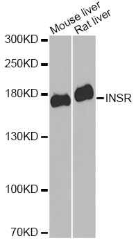 INSR / Insulin Receptor Antibody - Western blot analysis of extracts of various cell lines, using INSR antibody at 1:1000 dilution. The secondary antibody used was an HRP Goat Anti-Rabbit IgG (H+L) at 1:10000 dilution. Lysates were loaded 25ug per lane and 3% nonfat dry milk in TBST was used for blocking. An ECL Kit was used for detection and the exposure time was 90s.