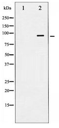 INSR / Insulin Receptor Antibody - Western blot of IR expression in COS7 whole cell lysates,The lane on the left is treated with the antigen-specific peptide.