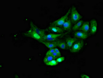 INSR / Insulin Receptor Antibody - Immunofluorescent analysis of HepG2 cells diluted at 1:100 and Alexa Fluor 488-congugated AffiniPure Goat Anti-Rabbit IgG(H+L)