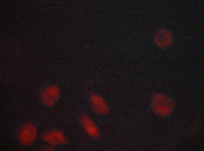 INSR / Insulin Receptor Antibody - Staining MCF-7 cells by IF/ICC. The samples were fixed with PFA and permeabilized in 0.1% saponin prior to blocking in 10% serum for 45 min at 37°C. The primary antibody was diluted 1/400 and incubated with the sample for 1 hour at 37°C. A Alexa Fluor® 594 conjugated goat polyclonal to rabbit IgG (H+L), diluted 1/600 was used as secondary antibody.