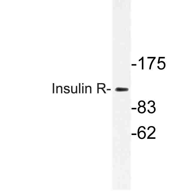 INSR / Insulin Receptor Antibody - Western blot of Insulin R (K1368) pAb in extracts from HepG2cells.