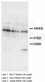 INSR / Insulin Receptor Antibody -  This image was taken for the unconjugated form of this product. Other forms have not been tested.