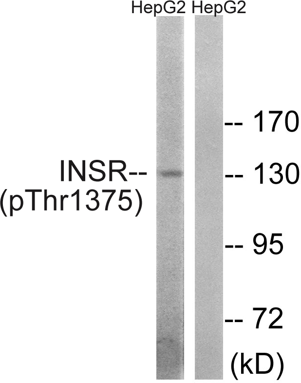 INSR / Insulin Receptor Antibody - Western blot analysis of lysates from HepG2 cells, using IR (Phospho-Thr1375) Antibody. The lane on the right is blocked with the phospho peptide.