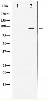 INSR / Insulin Receptor Antibody - Western blot of IR phosphorylation expression in Heatshock treated 293 whole cell lysates,The lane on the left is treated with the antigen-specific peptide.