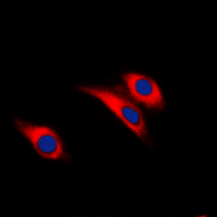 INSR / Insulin Receptor Antibody - Immunofluorescent analysis of Insulin Receptor (pY1361) staining in HEK293T cells. Formalin-fixed cells were permeabilized with 0.1% Triton X-100 in TBS for 5-10 minutes and blocked with 3% BSA-PBS for 30 minutes at room temperature. Cells were probed with the primary antibody in 3% BSA-PBS and incubated overnight at 4 deg C in a humidified chamber. Cells were washed with PBST and incubated with a DyLight 594-conjugated secondary antibody (red) in PBS at room temperature in the dark. DAPI was used to stain the cell nuclei (blue).