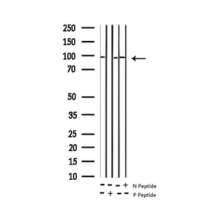 INSR / Insulin Receptor Antibody - Western blot analysis of Phospho-IR (Tyr1361) expression in various lysates