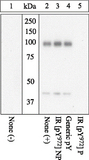 INSR / Insulin Receptor Antibody - Extracts of CHO-T cells transfected with an insulin receptor-containing vector and left unstimulated (1) or stimulated with 50 nM insulin for 5 minutes (2-5) were resolved by SDS-PAGE on a 10% Tris-glycine gel and transferred to PVDF. The membrane was blot.