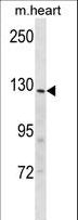 INSRR Antibody - Mouse Insrr Antibody western blot of mouse heart tissue lysates (35 ug/lane). The Insrr antibody detected the Insrr protein (arrow).