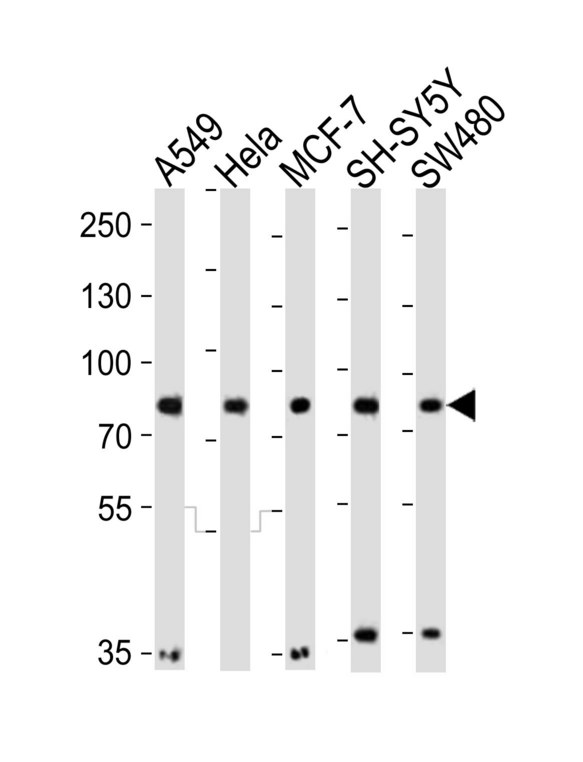 INSRR Antibody - Western blot of lysates from A549, HeLa, MCF-7, SH-SY5Y, SW480 cell line (from left to right) with INSRR Antibody. Antibody was diluted at 1:1000 at each lane. A goat anti-rabbit IgG H&L (HRP) at 1:10000 dilution was used as the secondary antibody. Lysates at 20 ug per lane.